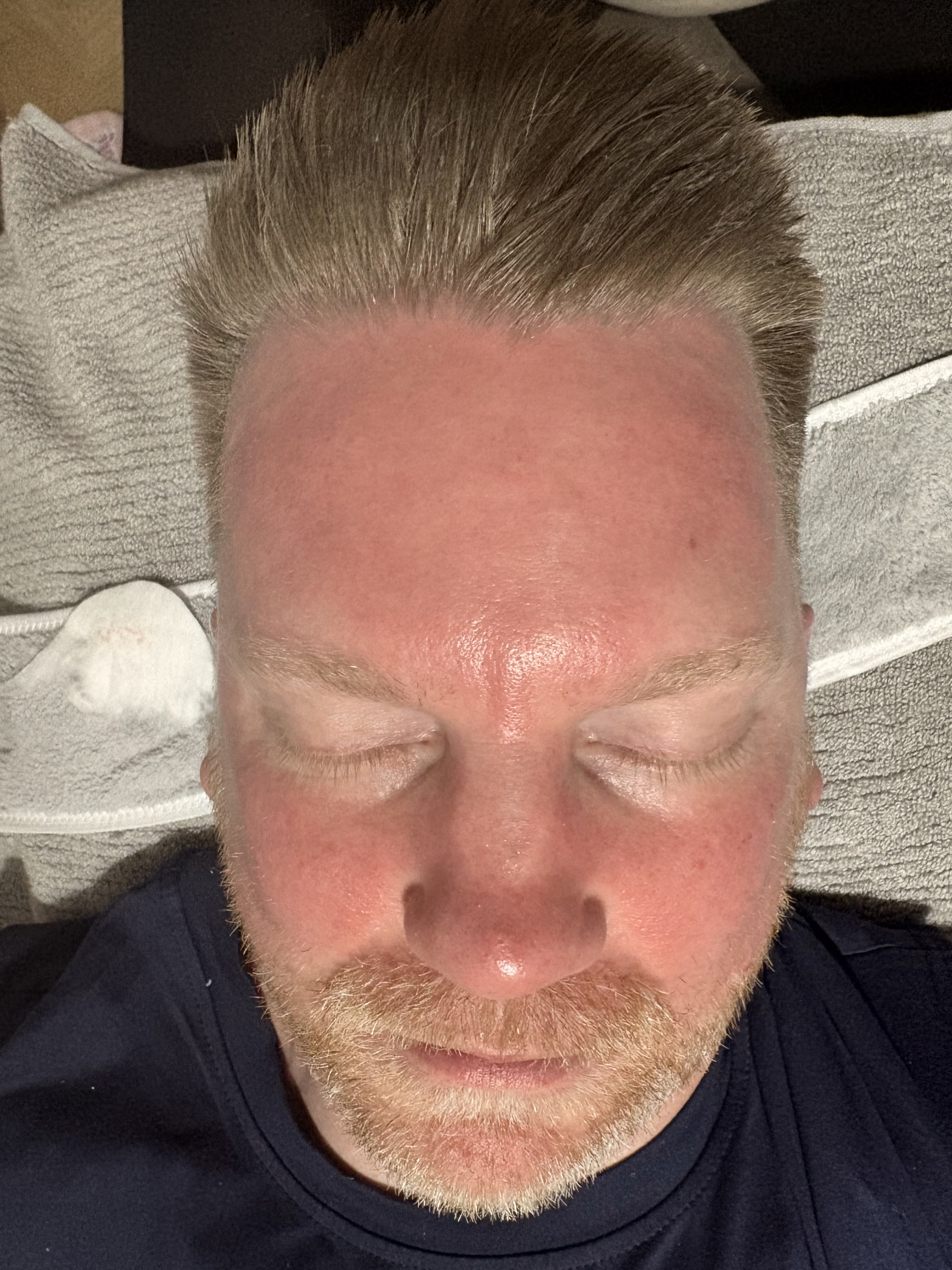 After treatment